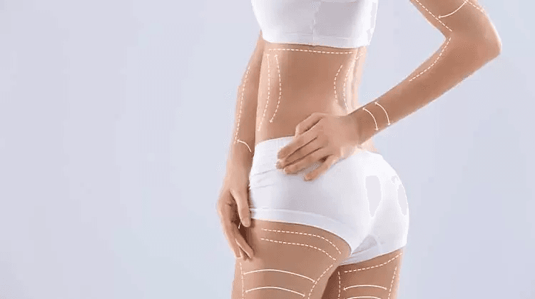 Estetică Corporală